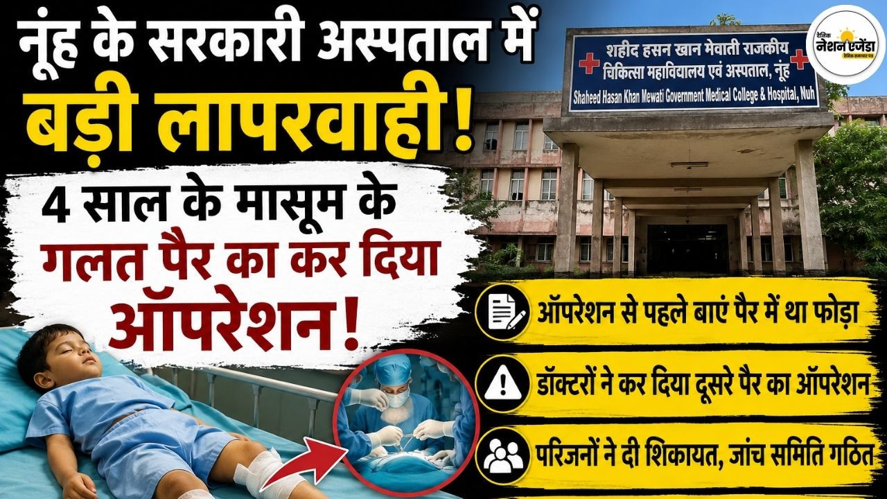 नूंह के सरकारी अस्पताल में बड़ी लापरवाही, 4 साल के मासूम के गलत पैर का कर दिया ऑपरेशन